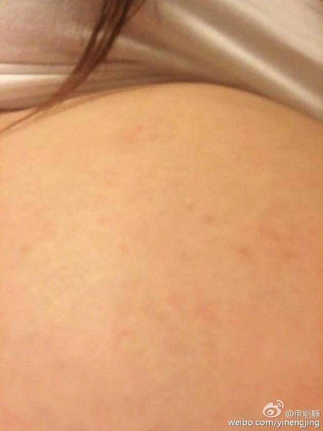 伊能靜臨產(chǎn)腳腫肚子過敏 伊能靜臨產(chǎn)腳腫肚子過敏