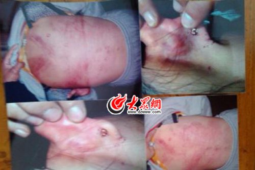 　山東藝術(shù)設(shè)計(jì)學(xué)院16歲女生宿舍內(nèi)被女同學(xué)暴打4小時(shí)。