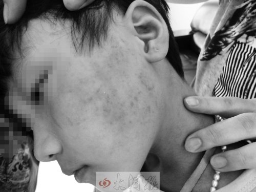 10歲女童向同學施暴 扇耳光擠肚子強迫舔腳趾 10歲女童向同學施暴 扇耳光擠肚子強迫舔腳趾