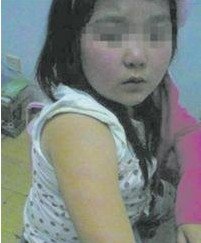 小學(xué)生沒考100分被老師打 兩個月不敢上學(xué) 小學(xué)生沒考100分被老師打 兩個月不敢上學(xué)