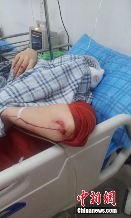 成都一女乘客自稱聞到焦臭味 公車行駛中砸窗跳車 成都一女乘客自稱聞到焦臭味 公車行駛中砸窗跳車