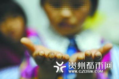 指尖被針扎得傷痕累累。