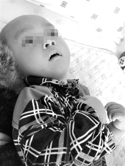 9月10日，陳揚(yáng)躺在醫(yī)院的病床上，他的眼睛仍然沒有聚焦感。新京報(bào)記者 朱柳笛 攝