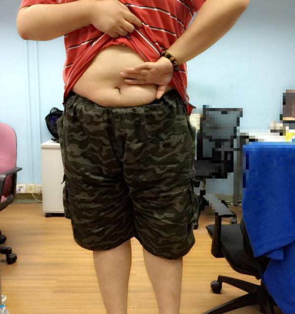 專(zhuān)家稱(chēng)操作不當(dāng)容易導(dǎo)致肩膀脫臼