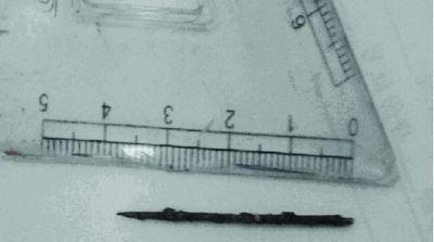 取出的繡花針已發(fā)黑生銹。