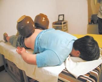 拔泡菜壇子火罐。