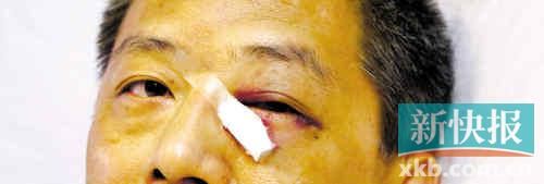 ■這起醫(yī)鬧事件，受傷的遠遠不只是熊旭明醫(yī)生的身體。