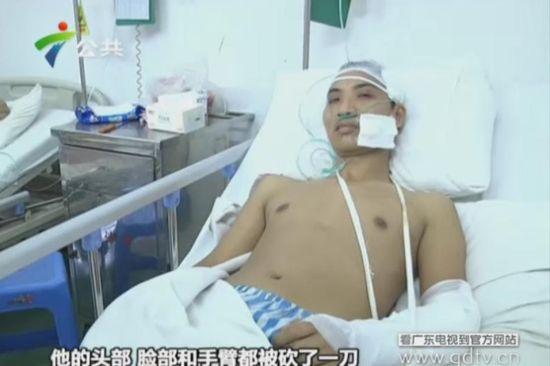 另一名傷者頭部、臉部和手臂都被砍了一刀。(視頻截圖)