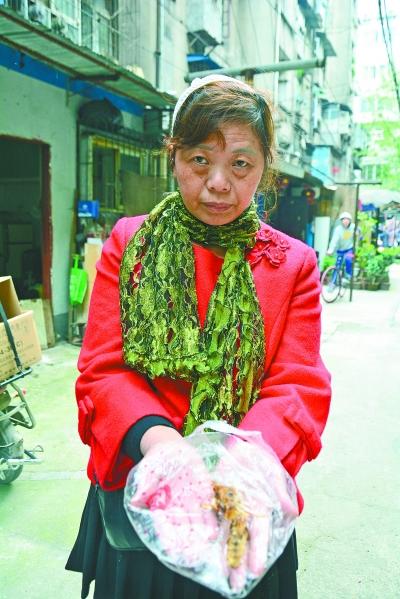 頭部受傷的黃女士展示兩根大魚(yú)刺。