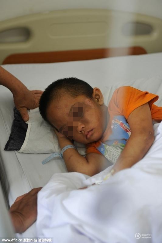 圖為全身傷痕累累的小進。