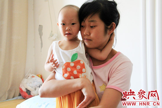 孩子和媽媽在一起，她的右眼已經(jīng)失明。