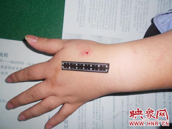 為幫助無證駕駛的朋友逃避處罰，新鄉(xiāng)的王某竟對執(zhí)勤民警大打出手，還將一名民警的手臂咬傷