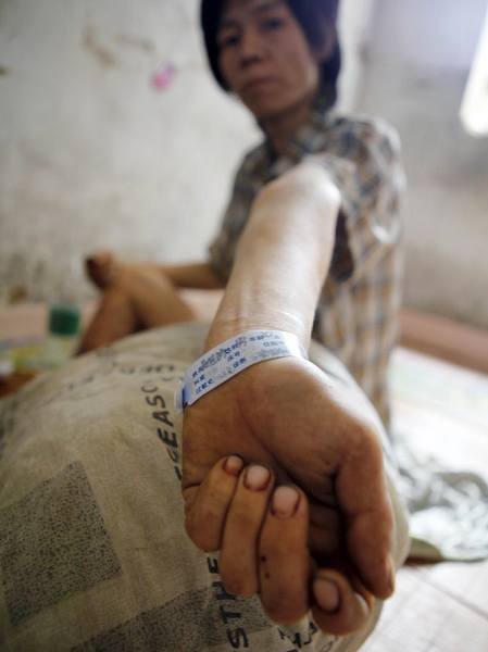 真實(shí)記錄一個(gè)吸毒者生命最后19天 真實(shí)記錄一個(gè)吸毒者生命最后19天