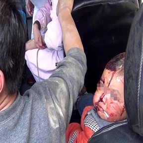 車(chē)禍母親用身體護(hù)幼子