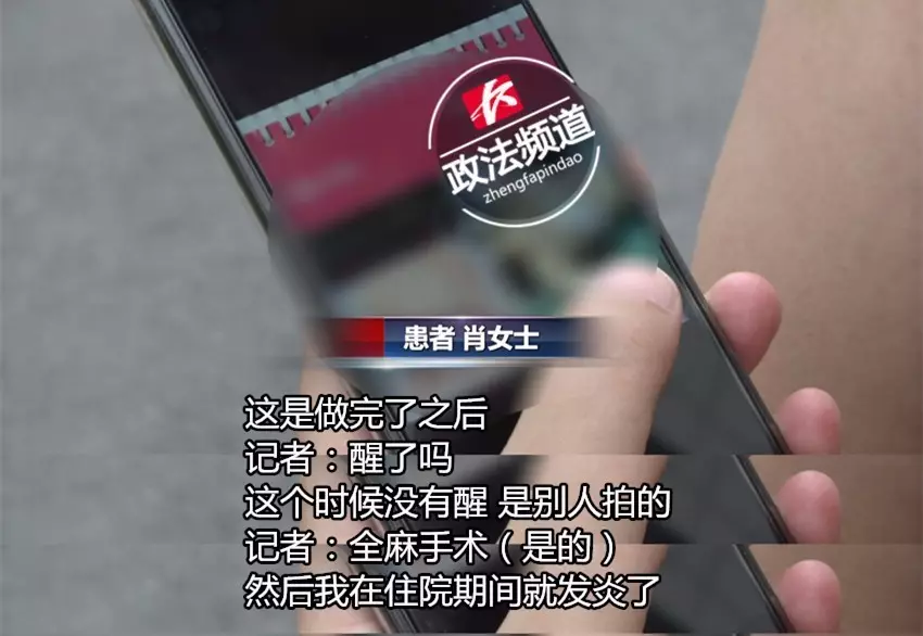 女子花近十萬做豐胸手術(shù) 術(shù)后胸部潰爛似被啃 女子花近十萬做豐胸手術(shù) 術(shù)后胸部潰爛似被啃