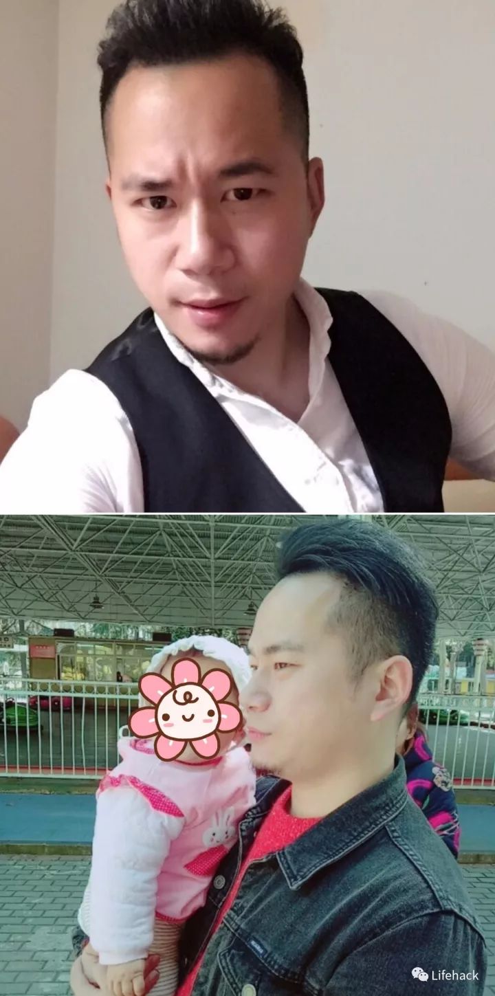 長胖20斤，臉型怎么變？這些例子看完扎心了！