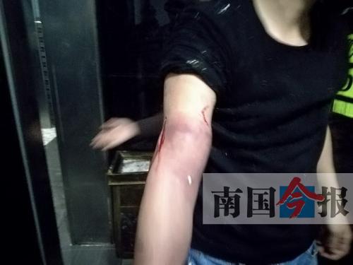 覃先生手臂被卡的部位受傷流血，所幸傷勢無大礙。 通訊員 王建民 攝