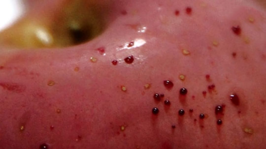 嚇懵！女子用熱水泡蘋(píng)果結(jié)果冒出血珠 咋回事？