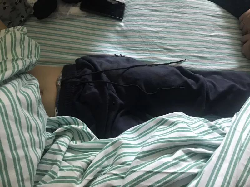 嚇哭！6歲男孩被夾斷手指 罪魁禍首竟是校服