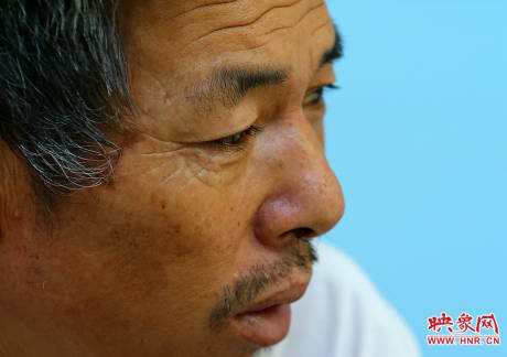 駐馬店失明雙胞胎手術成功 駐馬店失明雙胞胎手術成功