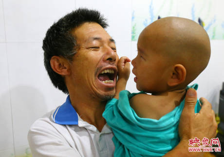 駐馬店失明雙胞胎手術成功 駐馬店失明雙胞胎手術成功