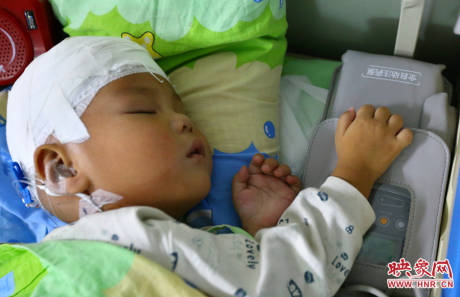 駐馬店失明雙胞胎手術成功 駐馬店失明雙胞胎手術成功