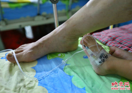 駐馬店失明雙胞胎手術成功 駐馬店失明雙胞胎手術成功
