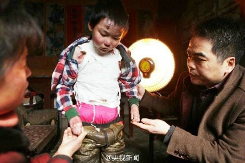 男孩皮膚一碰就破 裹衛(wèi)生紙堅持上學(xué) 男孩皮膚一碰就破 裹衛(wèi)生紙堅持上學(xué)