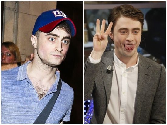 丹尼爾日前被拍到骨瘦如柴，不似2月份健康