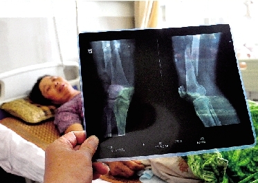 女環(huán)衛(wèi)工不慎墜入人行道深坑 施工方匆匆填坑回應含糊 女環(huán)衛(wèi)工不慎墜入人行道深坑 施工方匆匆填坑回應含糊