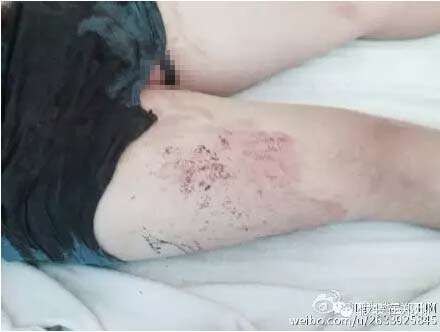 網(wǎng)友@我是大王啊 微博爆料圖片 網(wǎng)友@我是大王啊 微博爆料圖片