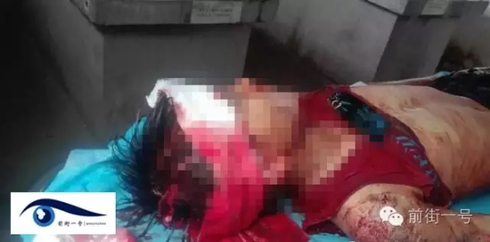 小山頭部受傷嚴重 小山頭部受傷嚴重