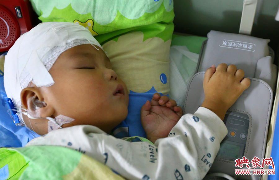 經(jīng)過手術(shù)，小龍病情已經(jīng)逐漸好轉(zhuǎn)，正在甜甜的熟睡