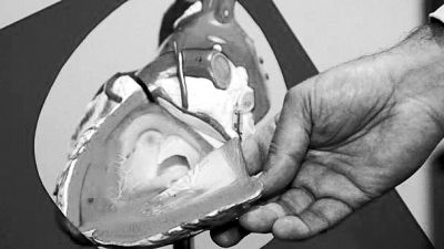 威廉斯領(lǐng)導(dǎo)的研究團(tuán)隊(duì)已經(jīng)利用人體脂肪干細(xì)胞，成功3D打印出心臟血管和心臟瓣膜，待一顆心臟的所有部件打