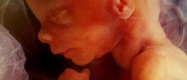 科學(xué)家研發(fā)可在子宮內(nèi)為胎兒做手術(shù)機(jī)器人 科學(xué)家研發(fā)可在子宮內(nèi)為胎兒做手術(shù)機(jī)器人