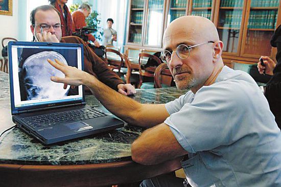 圖為卡納維洛醫(yī)生,不少人認為他的想法非常瘋狂 圖為卡納維洛醫(yī)生,不少人認為他的想法非常瘋狂