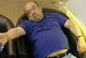 網(wǎng)傳金正男中毒后的照片。