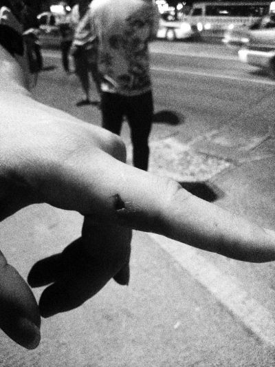 民警食指被咬傷。