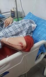 砸窗當(dāng)事人胡女士在醫(yī)院接受治療。