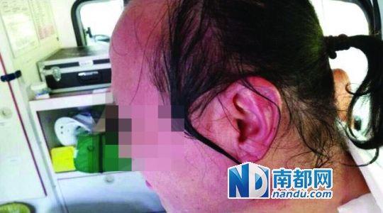 涉事教師遭熱水潑臉后的照片。