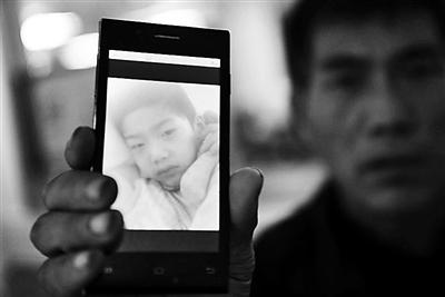 河北7歲男童誤把農藥當牛奶喝致肺部全黑 河北7歲男童誤把農藥當牛奶喝致肺部全黑