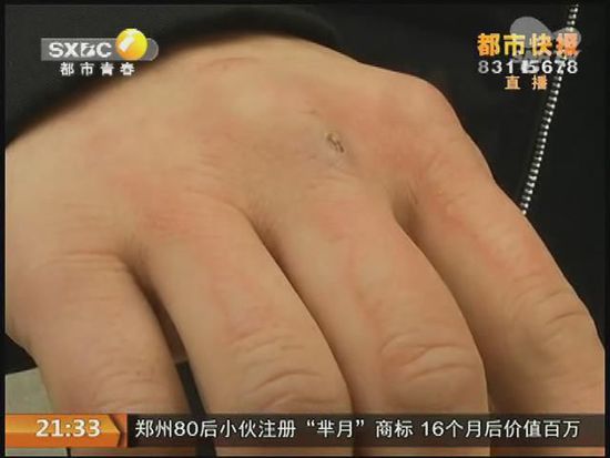 說(shuō)到這足療拔罐，估計(jì)大伙都不陌生，但是想起4號(hào)晚上的拔罐的經(jīng)歷，呂先生現(xiàn)在想起來(lái)，還心有余悸。