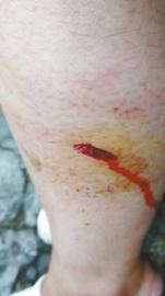 郭女士腿上被猴子咬的傷口。(受訪者供圖)