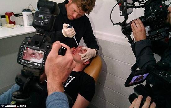 該實(shí)驗(yàn)是由加州一支名為“生物駭客”的實(shí)驗(yàn)團(tuán)隊(duì)開展的。他們使用了一種名為二氫卟吩e6（Ce6）的物質(zhì)的溶液。Ce6常見于深海魚體內(nèi)，有光敏特性，通常用于癌癥治療研究中。研究團(tuán)隊(duì)將Ce6與胰島素和鹽水混合起來，得到一種溶液，可以在低光照條件下提高人類的視力。