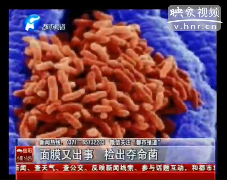 面膜又出事 檢出奪命菌