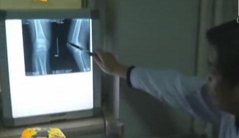 冷空氣來襲 如何預(yù)防老寒腿？