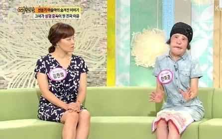 美女整容變“電風(fēng)扇大媽” 盤(pán)點(diǎn)整容失敗驚悚案例